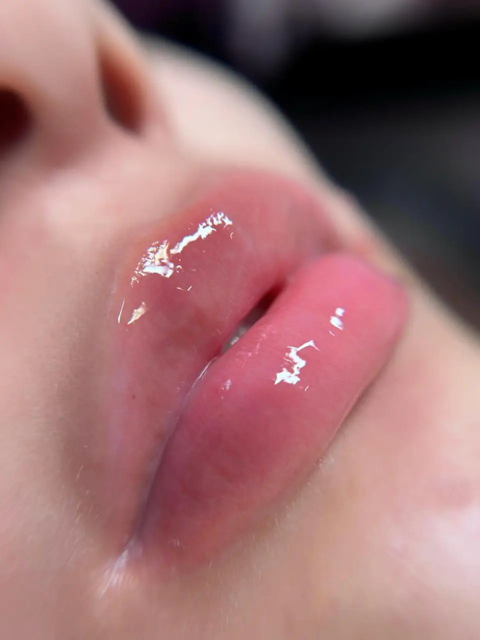 Hydra Gloss Lips