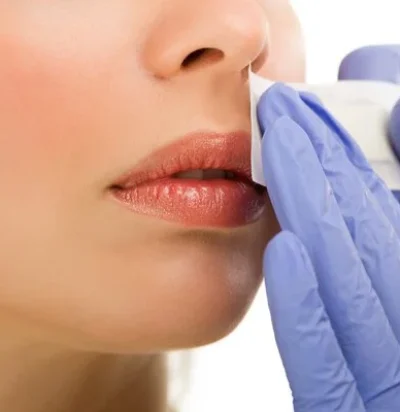 Upper Lip hair waxing