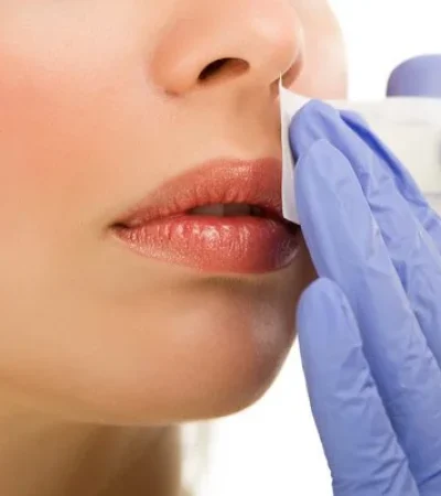 Facial waxing