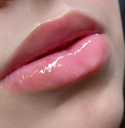 Hydra Gloss