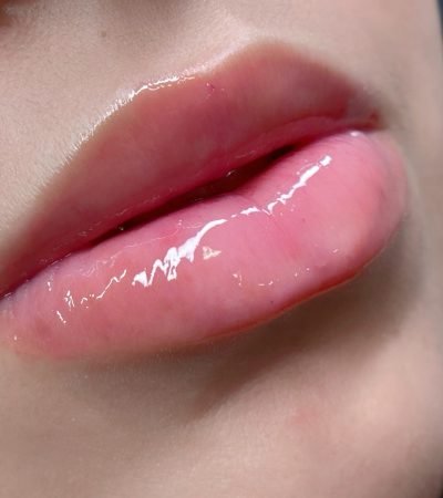 Hydra Gloss