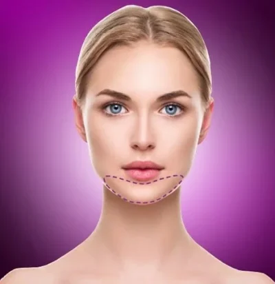 Chin hair waxing
